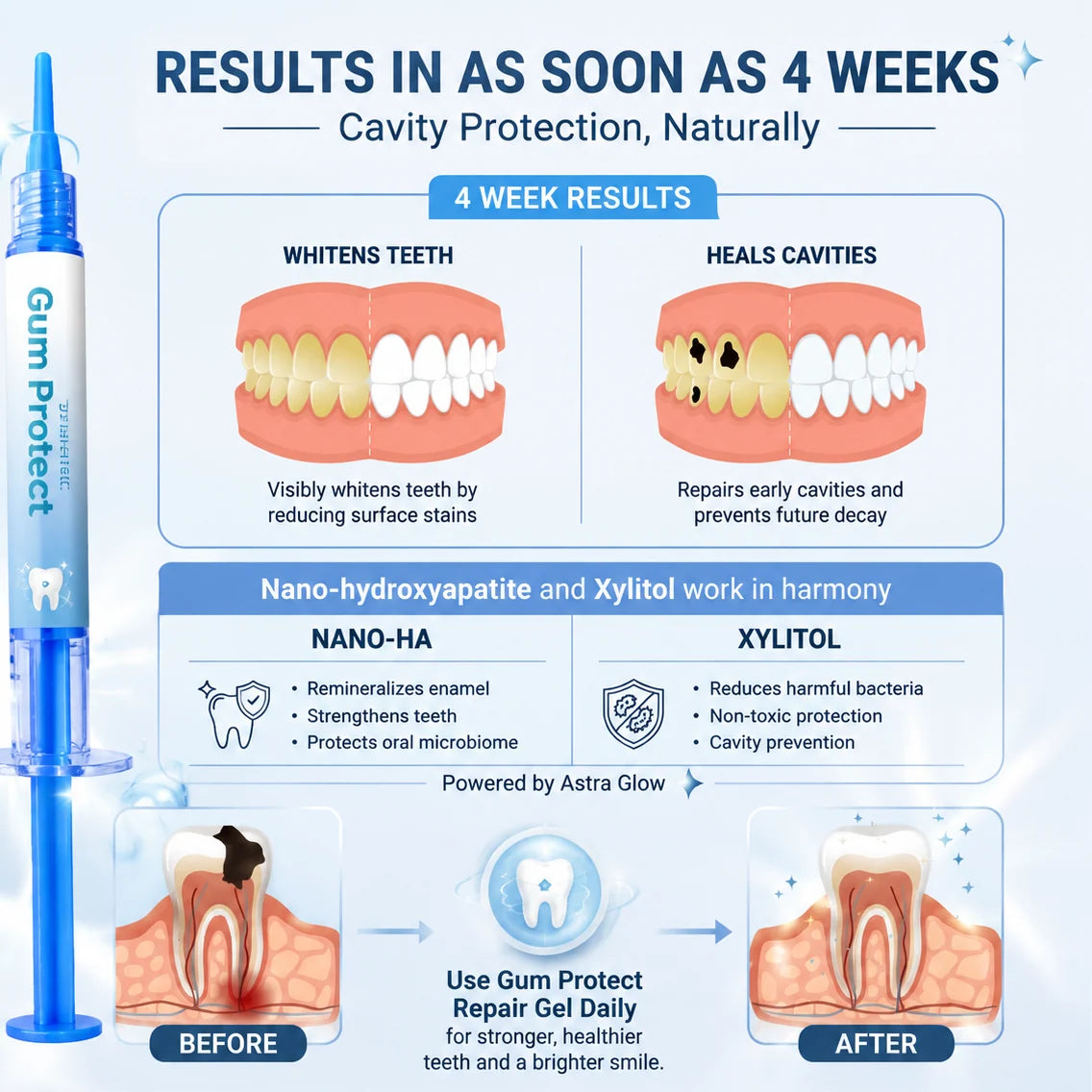 Teeth Repair Gel Whitening Pen — The Same Active Dentists Use, Without the Chair