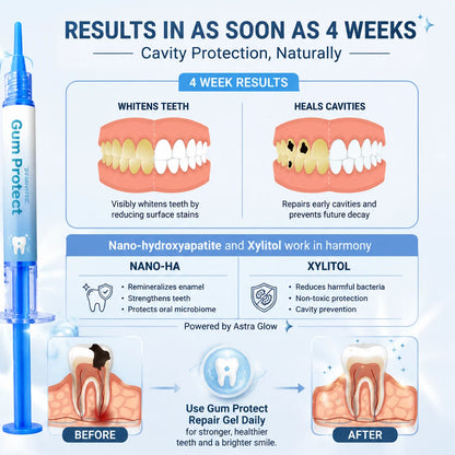 Teeth Repair Gel Whitening Pen — The Same Active Dentists Use, Without the Chair