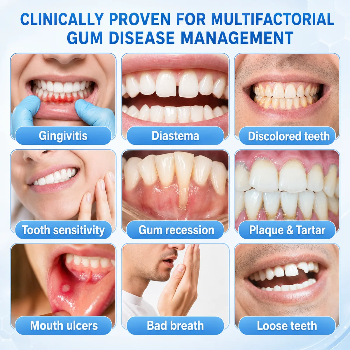 Teeth Repair Gel Whitening Pen — The Same Active Dentists Use, Without the Chair