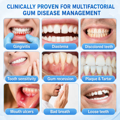 Teeth Repair Gel Whitening Pen — The Same Active Dentists Use, Without the Chair