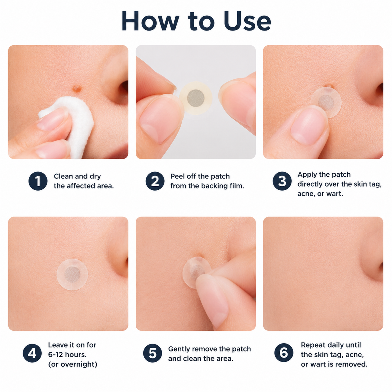 ✨Hydranya®2-in-1 Microneedle & Hydrocolloid Patch🍀| Removes Raised Moles, Acne, Flat Warts & Skin Tags | Helps Improve Wrinkles, Scars & Blemishes | Invisible Patches for Face & Body
