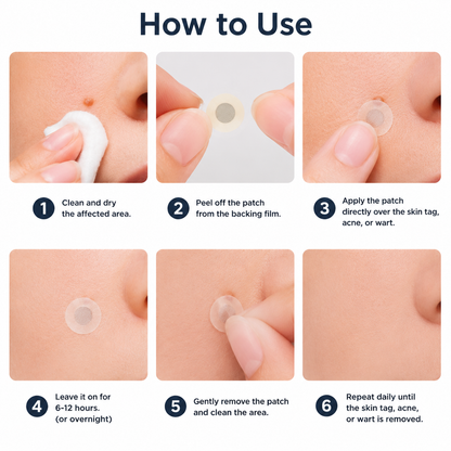 ✨Hydranya®2-in-1 Microneedle & Hydrocolloid Patch🍀| Removes Raised Moles, Acne, Flat Warts & Skin Tags | Helps Improve Wrinkles, Scars & Blemishes | Invisible Patches for Face & Body
