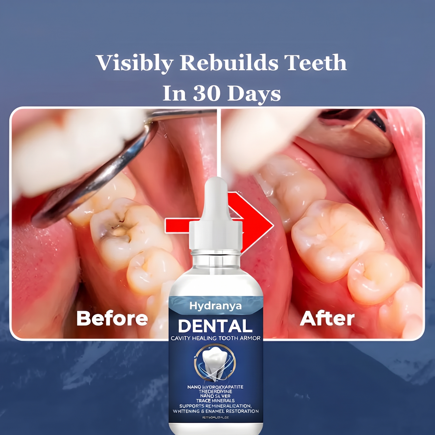 Hydranya™ Advanced Enamel Repair & Whitening Kit (Includes Free LED Mirror)