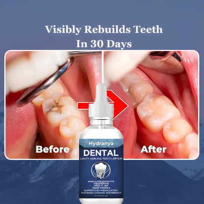Hydranya™ Advanced Enamel Repair & Whitening Kit (Includes Free LED Mirror)