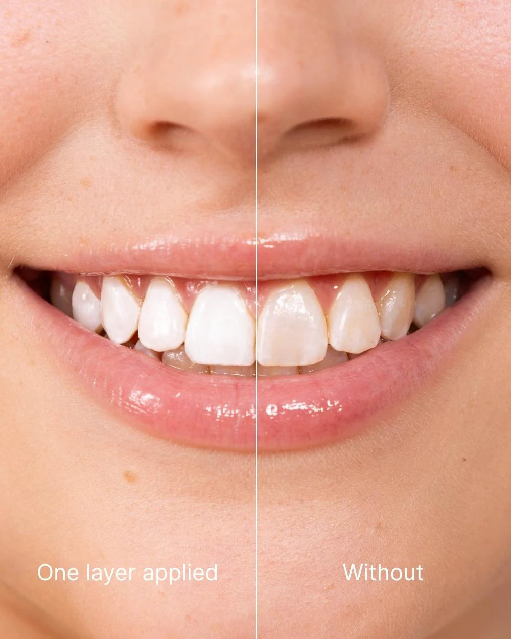Hydranya® Tooth Polish - Instant White Smile