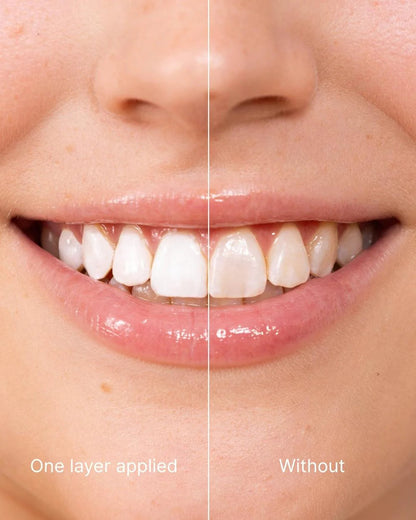 Hydranya® Tooth Polish - Instant White Smile