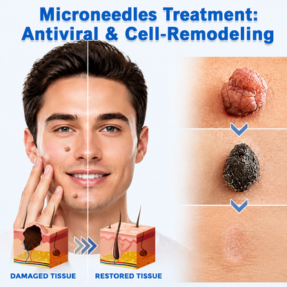 ✨Hydranya®2-in-1 Microneedle & Hydrocolloid Patch🍀| Removes Raised Moles, Acne, Flat Warts & Skin Tags | Helps Improve Wrinkles, Scars & Blemishes | Invisible Patches for Face & Body