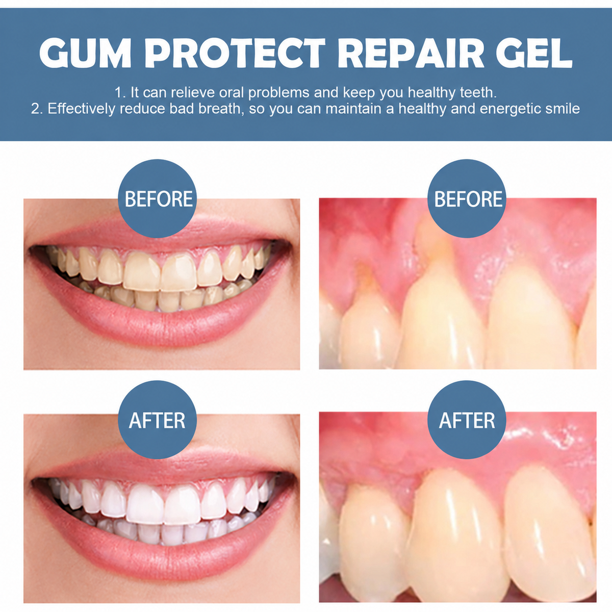 Hydranya™ Gum Repair Gel
