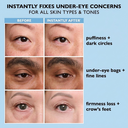 Hydranya™ Instant Face Temporary Tightener – Instant visible results in 60 seconds